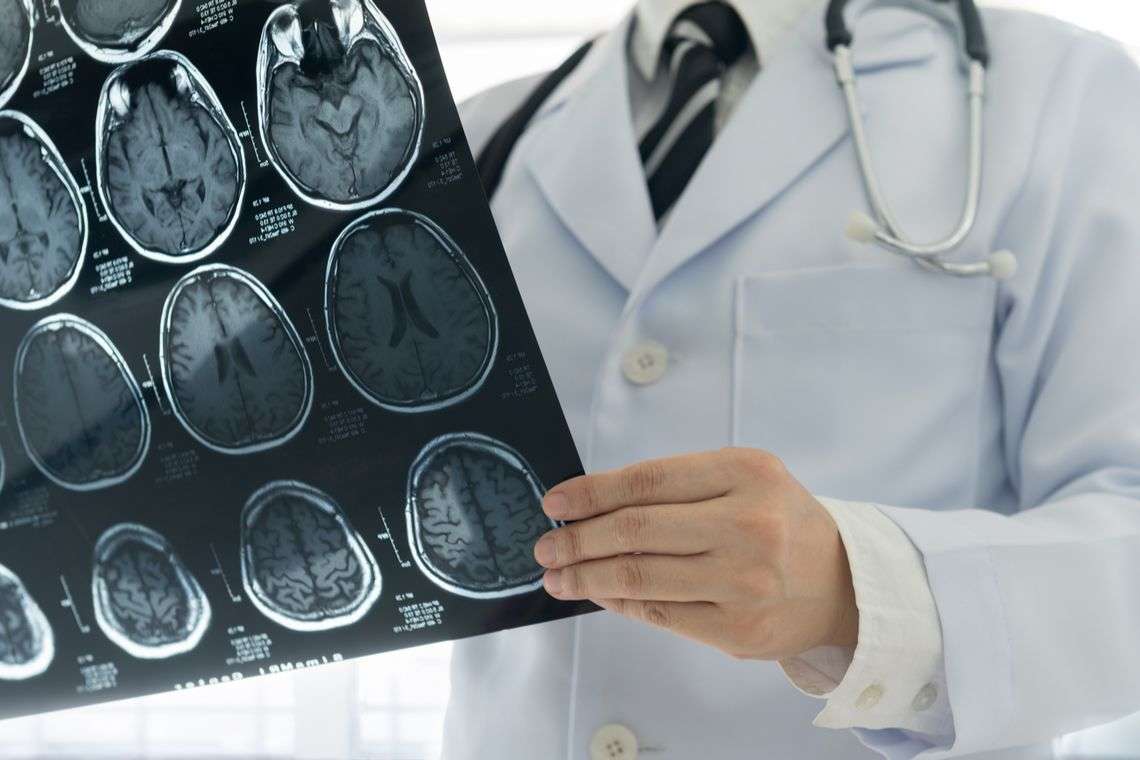 Neurovascular Stent Lawsuit Hero Image